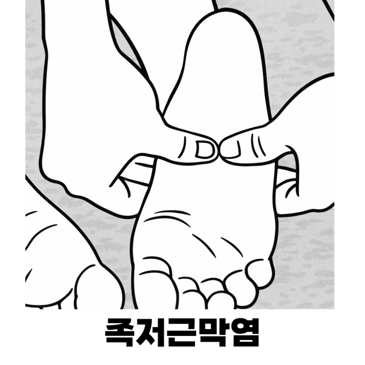  아침 발뒤꿈치 통증? 족저근막염 의심해보세요!