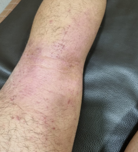 울산피부질환피부과? 대학병원까지 가도 가려움에서 못 벗어나는 분들이 놓친 1가지.