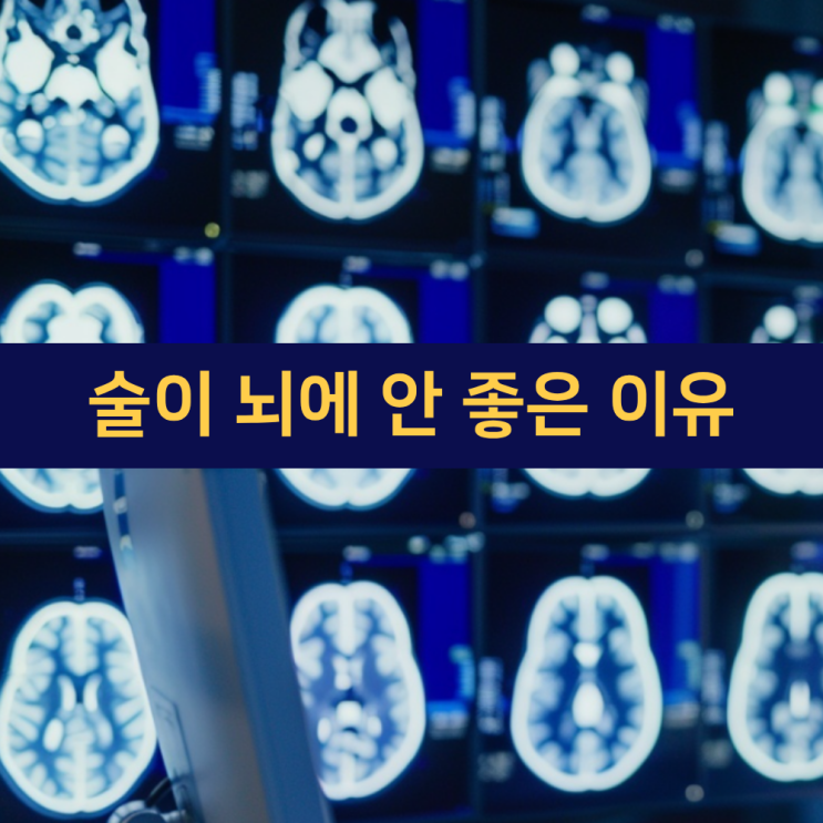  술이 뇌에 안 좋은 이유 | 전두엽손상 | 뇌건강 | 베르니케-코르사코프 증후군