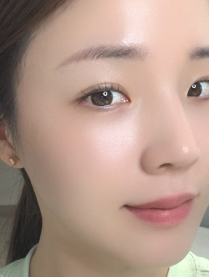 창원 상남동 피부관리 여드름, 수분재생관리 잇츠메디올 후기