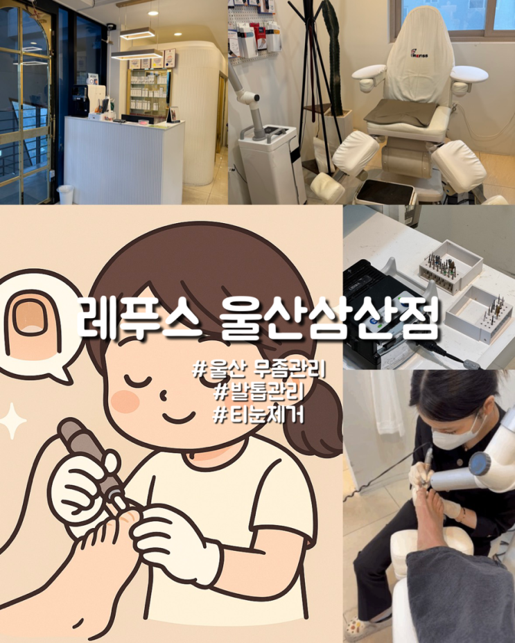 발 관리전문 울산무좀발톱 내성발톱 레푸스 울산삼산점