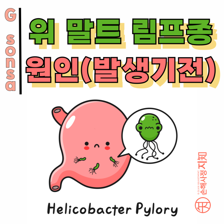  위말트림프종 원인 – 착한 면역세포가 암세포가 되는 순간 - [의학정보, AlDa]