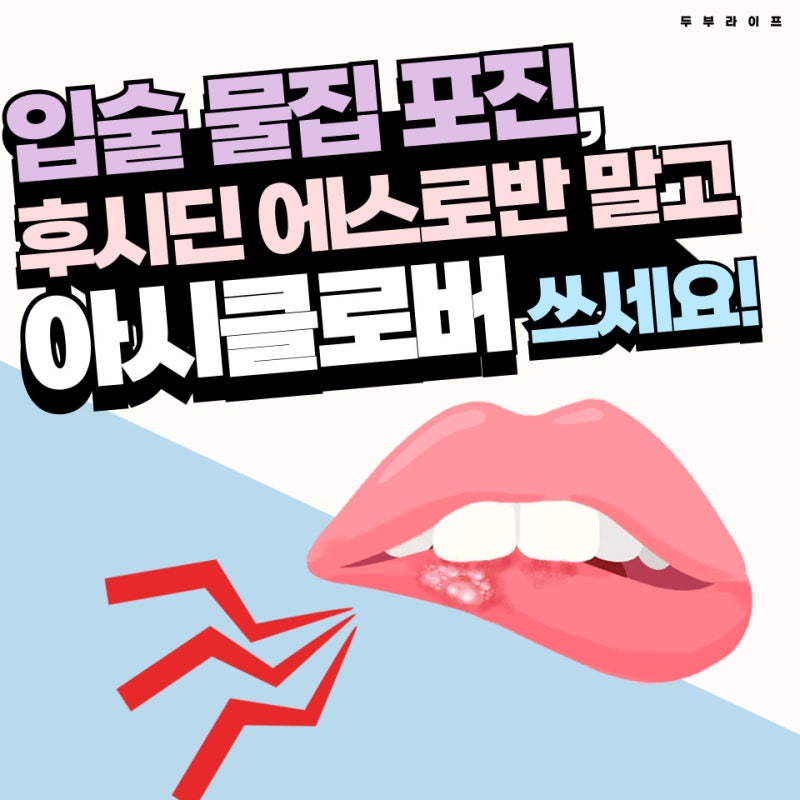 입술 물집·구순포진 연고 정리 │ 아시클로버 사용 시 확인할 점