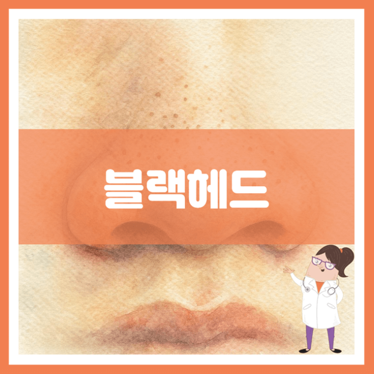  블랙헤드 원인 증상 관리
