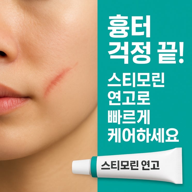  스티모린 연고, 무엇이고 어떻게 써야 할까?
