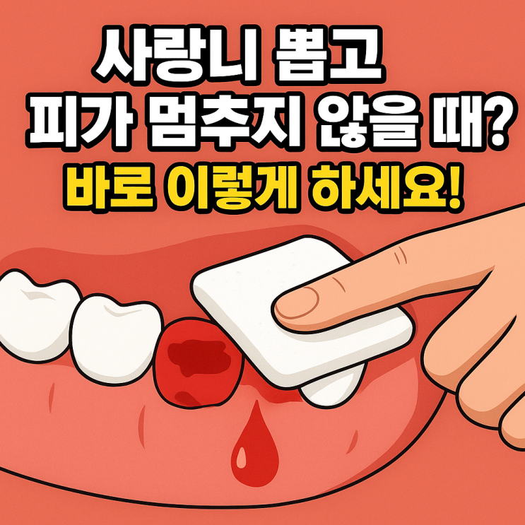   사랑니 발치 후 피가 멈추지 않을 때 대처법