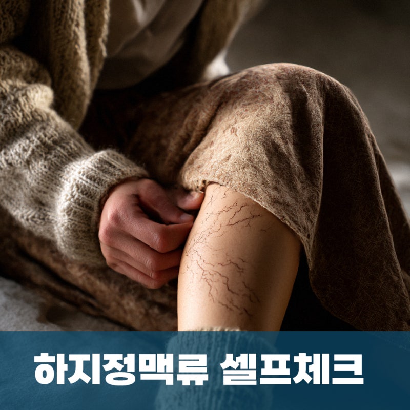 김해 장유 하지정맥류, 어느 정도면 수술이 필요할까?– 셀프체크 가이드와 ‘내원 타이밍’....