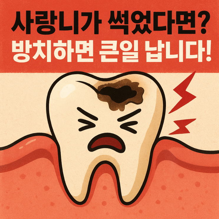   사랑니가 썩었을 때 생기는 문제와 치료 방법