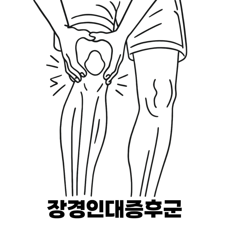 러너스니? 장경인대증후군?