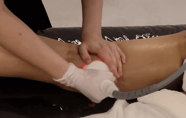  허벅지 지방흡입 후 단단한 느낌? 바이오본드(바본) 관리로 매끄러운 라인 회복하기