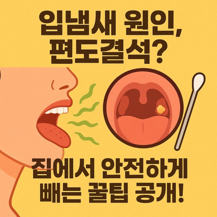  편도결석 빼는 법｜냄새 원인부터 안전하게 제거하는 꿀팁