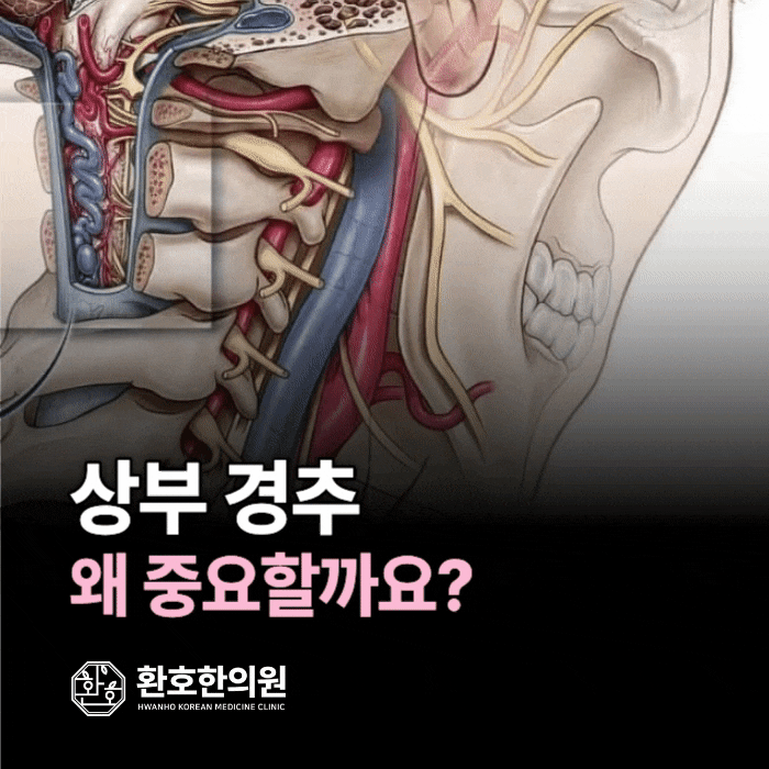  상부경추 교정, 작은 틀어짐이 전신을 바꾼다