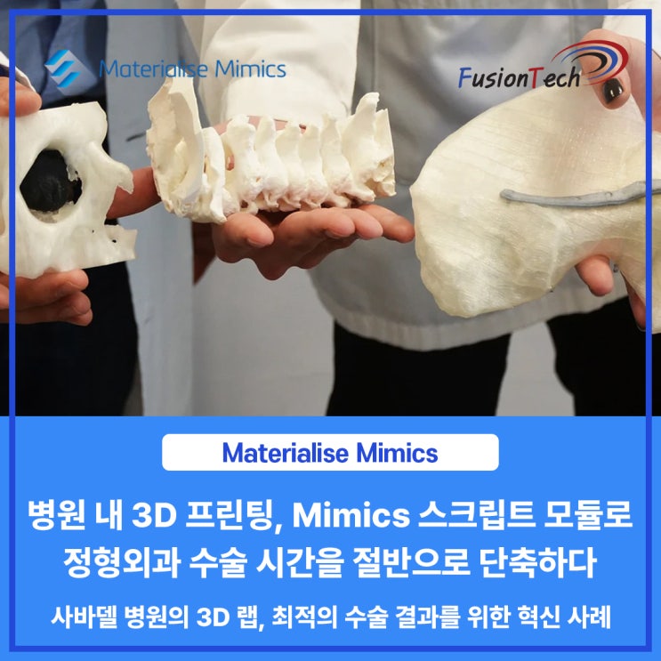  [Materialise S/W] 병원 내 3D 프린팅, Mimics 스크립트 모듈로 정형외과 수술 시간을 절반으로 단축하다. [사바델 병원의 3D 랩, 최적 수술 결과 혁신 사례]
