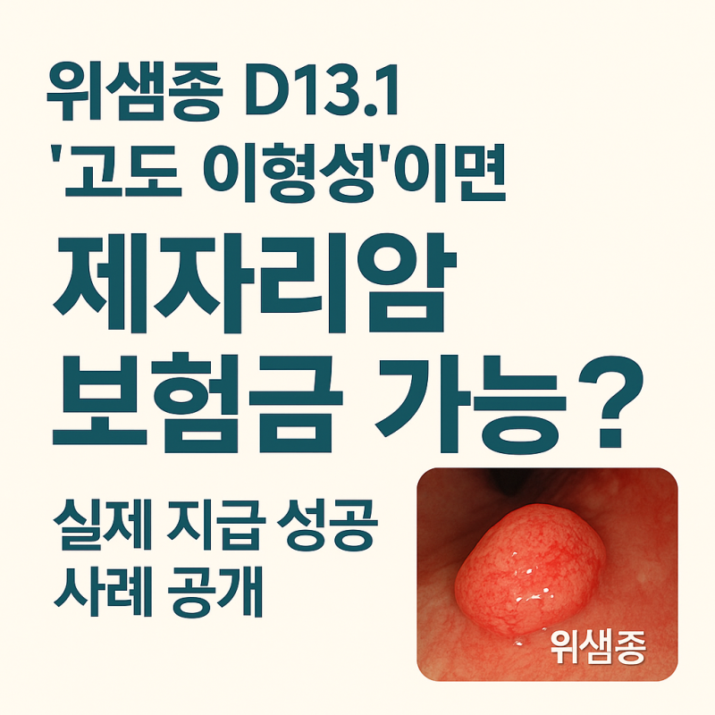 “위샘종 D13.1 ‘고도 이형성’이면 제자리암 보험금 가능? 실제 지급 성공 사례 공개”