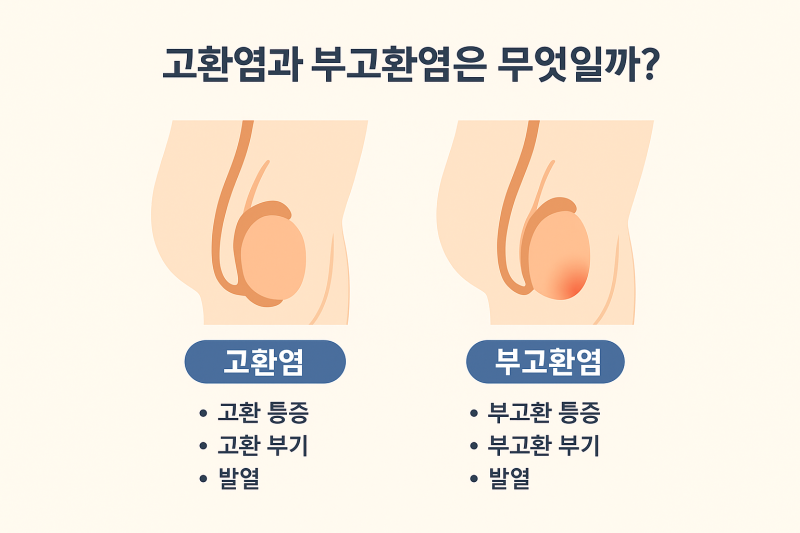 남성 생식기 통증의 원인, 고환염·부고환염 구별법