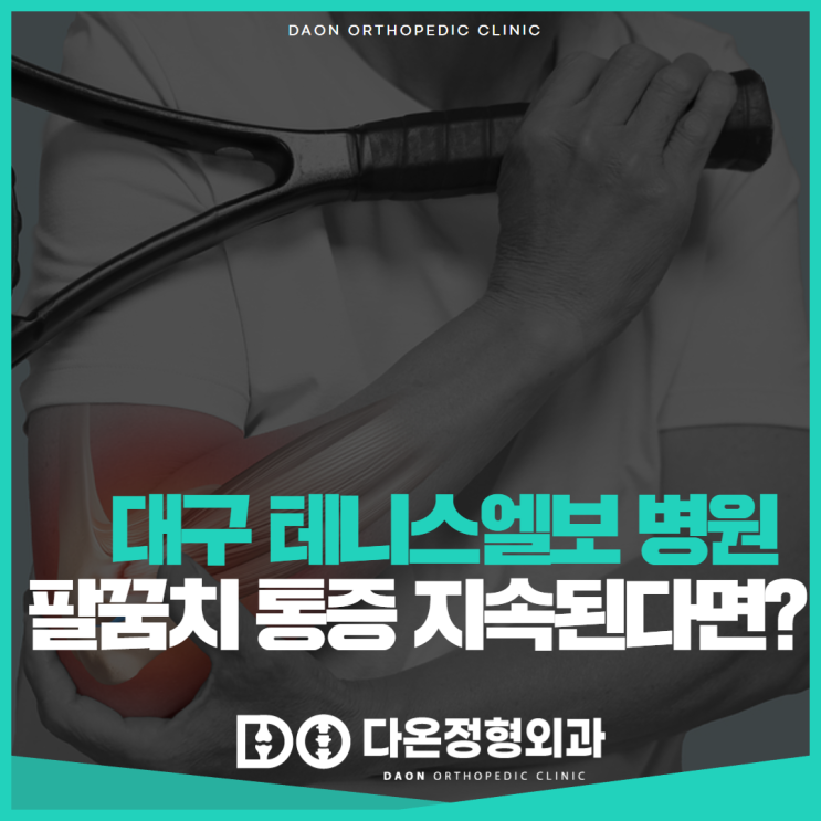  대구 테니스엘보 잘보는 곳, 팔꿈치 통증이 반복된다면 의심