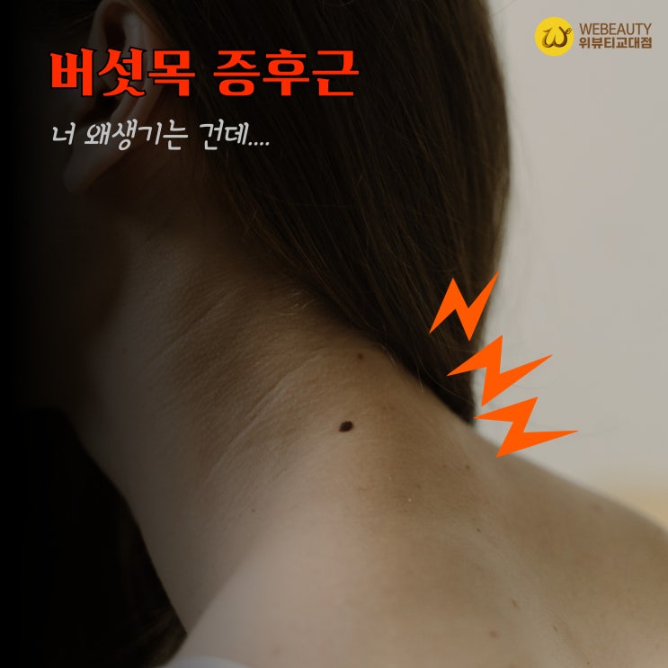  교대역 피부관리실] 버섯목증후근 체형 교정이 필요한 이유 두통(사진있음)
