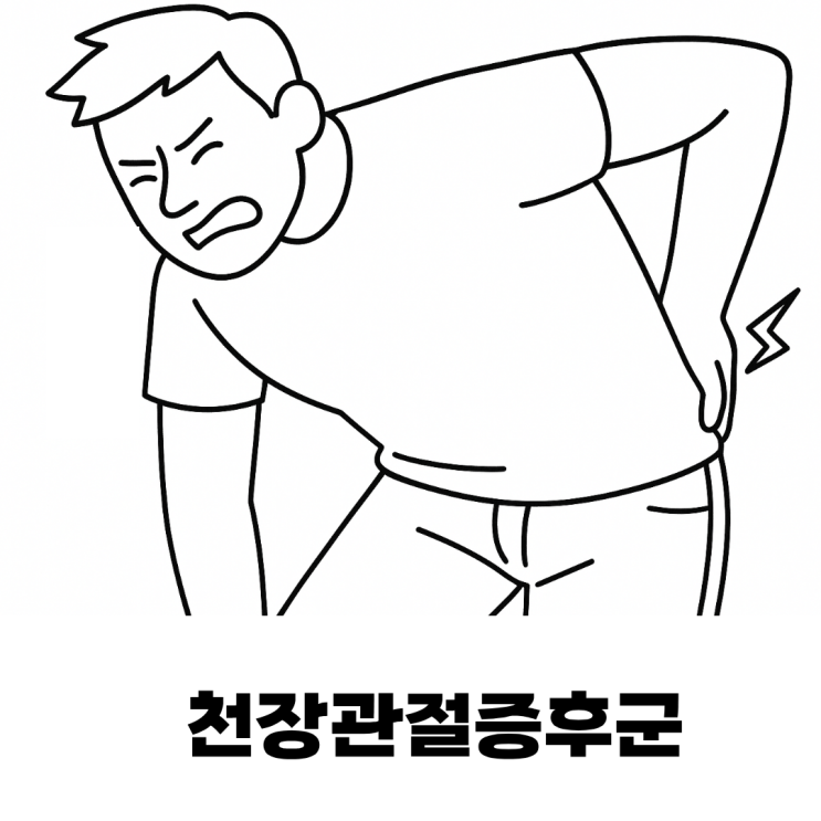  허리보다 엉덩이가 아프다면? 천장관절 문제 의심해보세요!