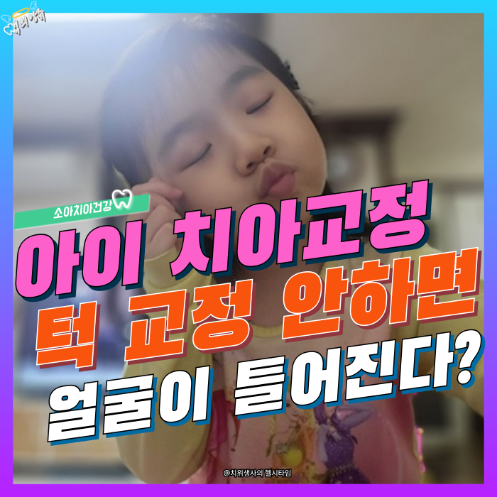 소아 교정 필수! Angle씨 부정교합 분류법과 2급·3급 교정 방법