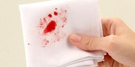 목에서 피날때 인후두염 출혈 객혈 원인 각 증상 별 치료 관리 방법
