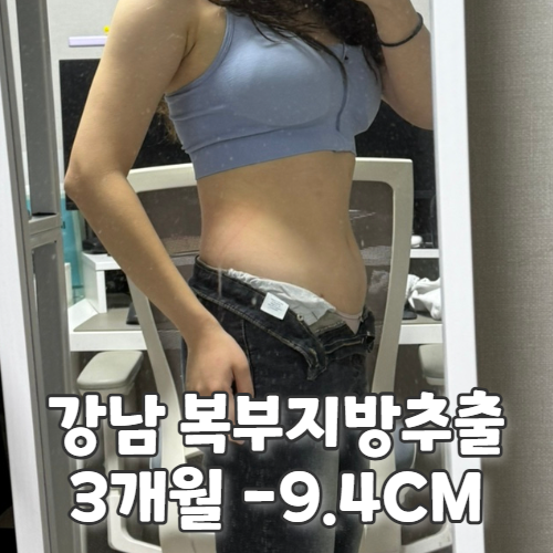  강남 복부 지방추출주사 3개월 후기, -9.4cm 감량 성공 전후 비교