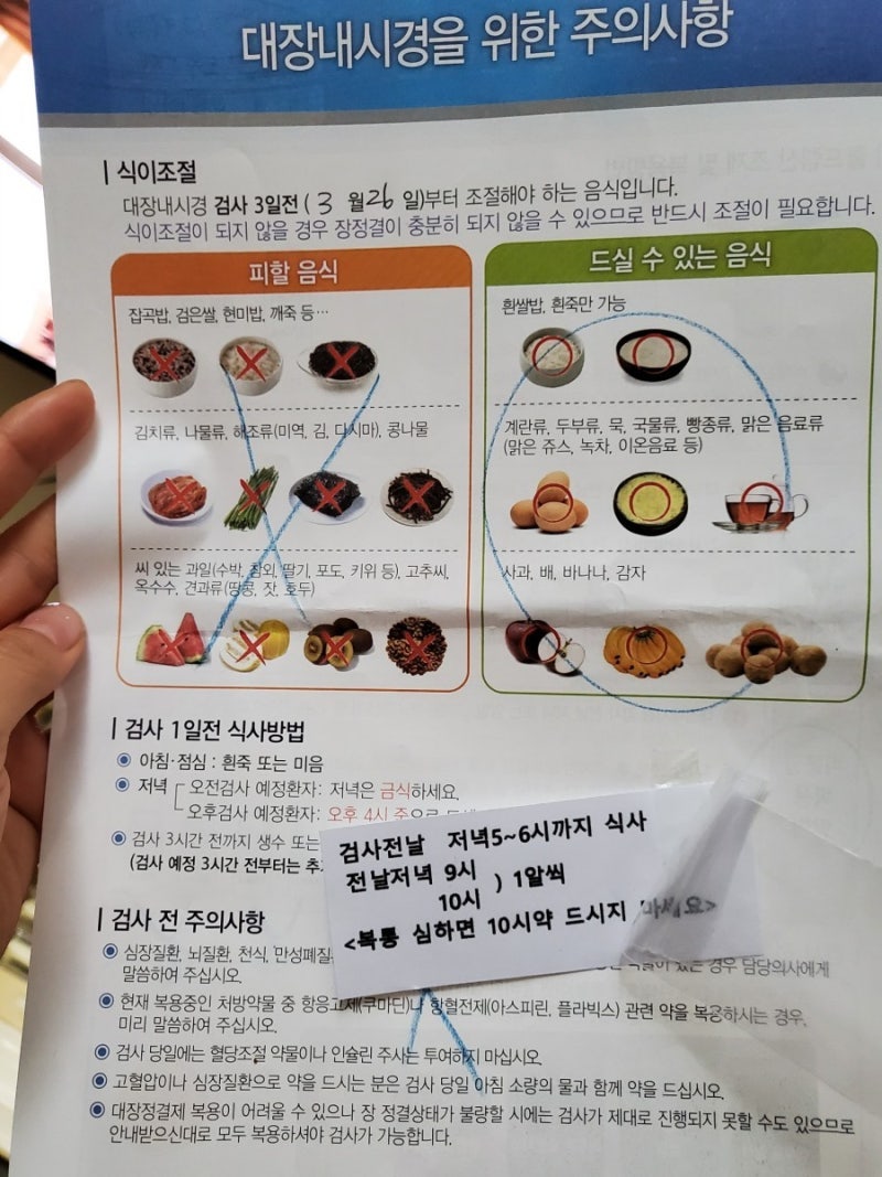 대장 내시경 후기