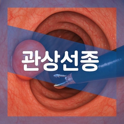 저도 이형성 관상선종이란? 저등급 선종 뜻 알아보자