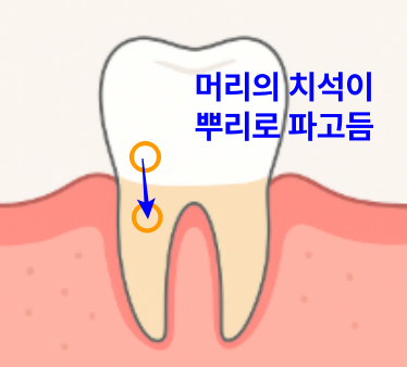 체계적으로 잇몸을 관리하는 방법 - 풍치 치료 과정, 치료 주기, 통증 등에 대해 발산역 치과....