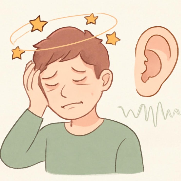 메르니에병 [메니에르병 증상, 어지럼증, 이명, 청력저하]