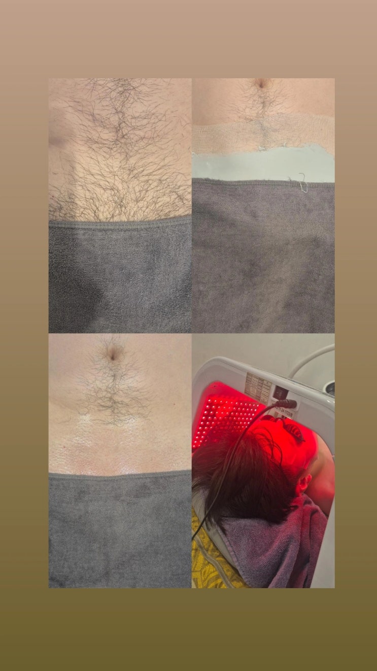  남자 브라질리언 왁싱은 제대로 된 곳에서 풀 케어 서비스를 받으며 받자. 영등포 남자 왁싱샵 "청춘케어"