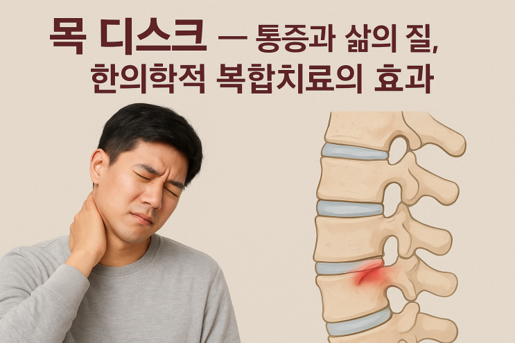  목 디스크, 수술 없이 회복할 수 있을까?