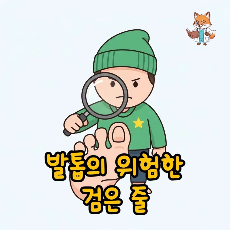 엄지발톱 흑색종 증상, 이 검은 세로줄 절대 무시 마세요