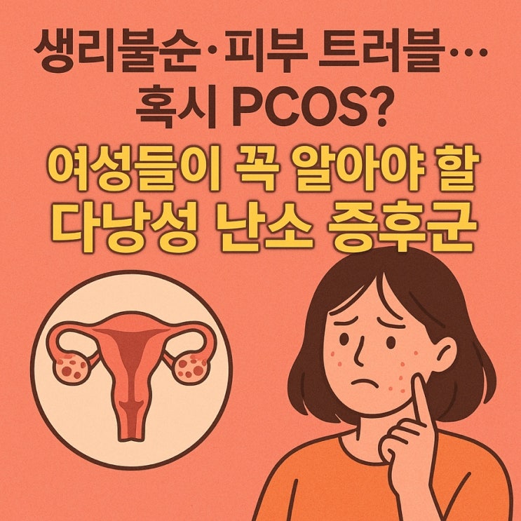  다낭성 난소 증후군(PCOS) 원인·증상·관리법 총정리 