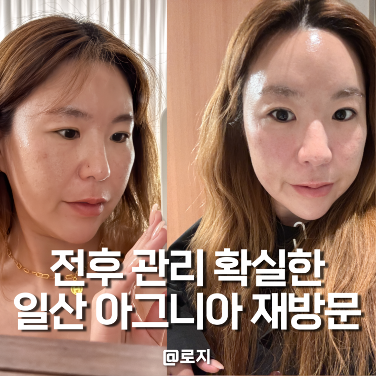  일산 피부관리 경락 등관리 잘하는 곳 아그니아 스킨앤바디 일산점 재방문 후기