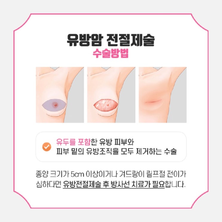  생각할 수록 신기한 유방암 초기 수술 후기..