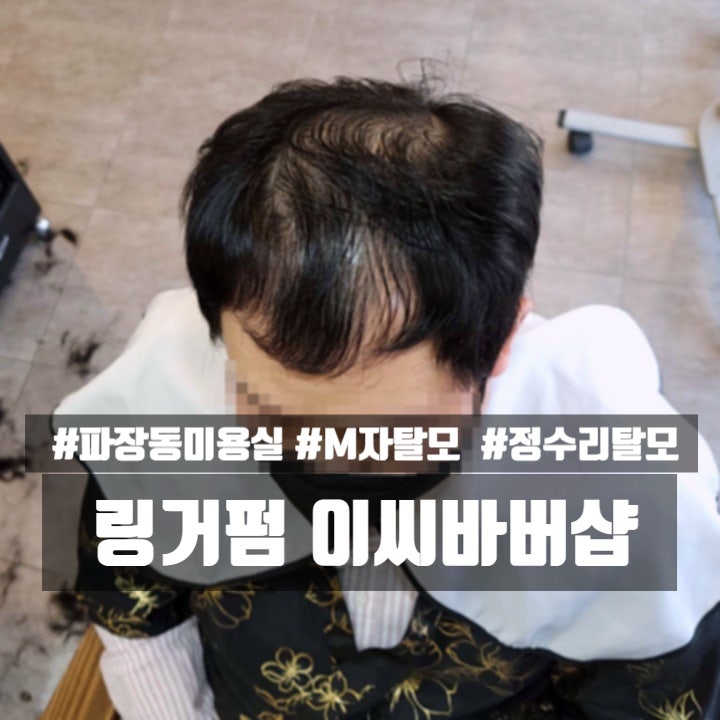  얇은 머리카락을 가진 탈모가 진행 중이던 40대 남성, 수원바버샵 파장동미용실에서 링거펌으로 자연스럽게 커버했어요