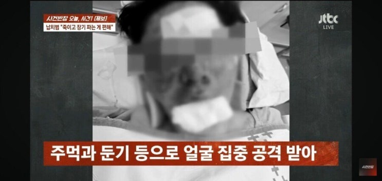 100만 <b>유튜버 수탉</b>, '<b>납치</b>·살인<b>미수</b>' 피해… 안와골절 등... 