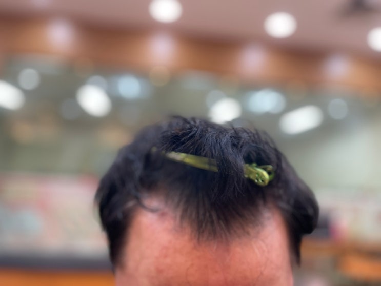  남자 심한 탈모 정기적인 토탈탈모교정펌으로 탈모 걱정 이젠 뚝 부산사상르네시떼미용실/ 사상김해화명하단덕천모라학장가야다대대저서면부전양정연제수영망미토곡안락남포보수동