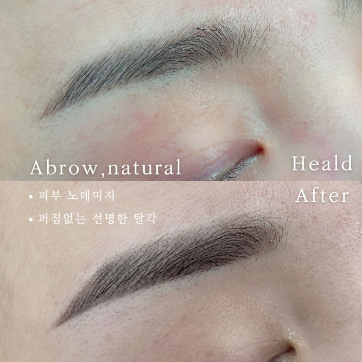  천안눈썹문신, 잔흔눈썹에는 왜 옴브레를 추천하는가?