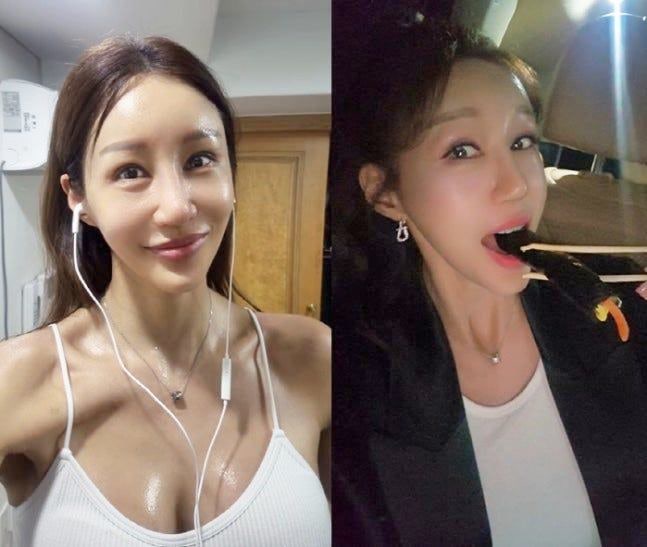 가수 김혜연, 나이·남편·자녀·가족·성형 이야기 총정리
