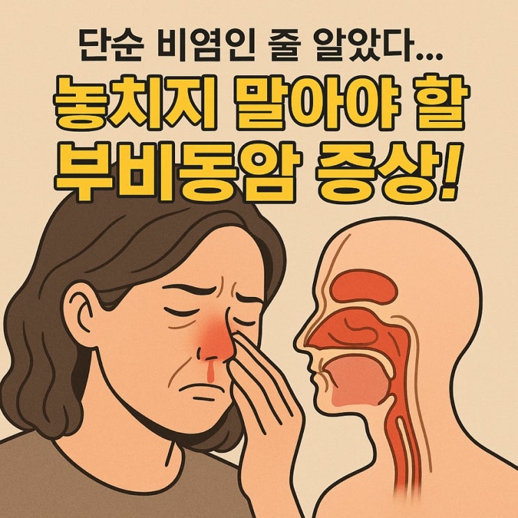   부비동암, 놓치기 쉬운 초기 증상과 치료 핵심 가이드