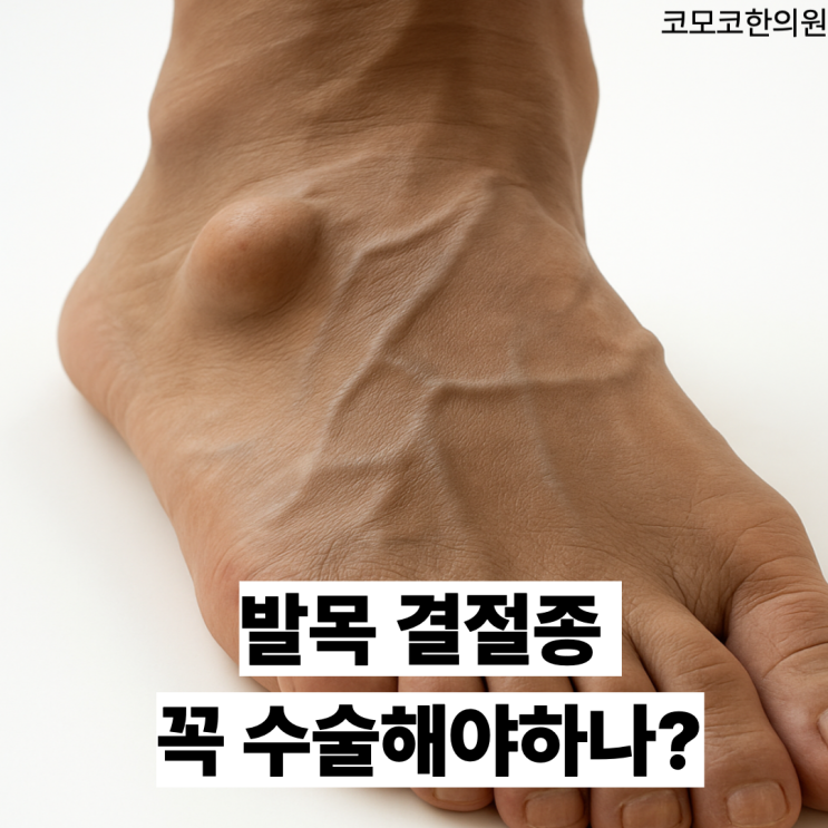  발목과 발가락에 생긴 결절종 치료는 어떻게 할까요?