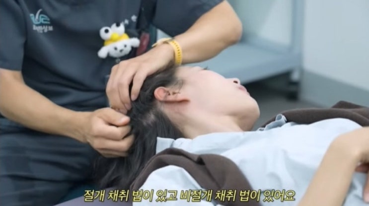  이현이 산후 탈모 솔루션과 모발 이식의 현실, ‘워킹맘이현이’에서 털어놓은 진짜 고민