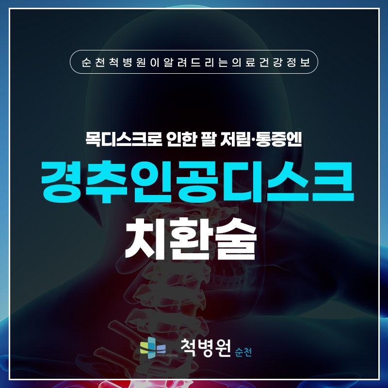 순천 목디스크 수술, 팔 저림·통증 경추 인공디스크 치환술로 회복 순천 신경외과