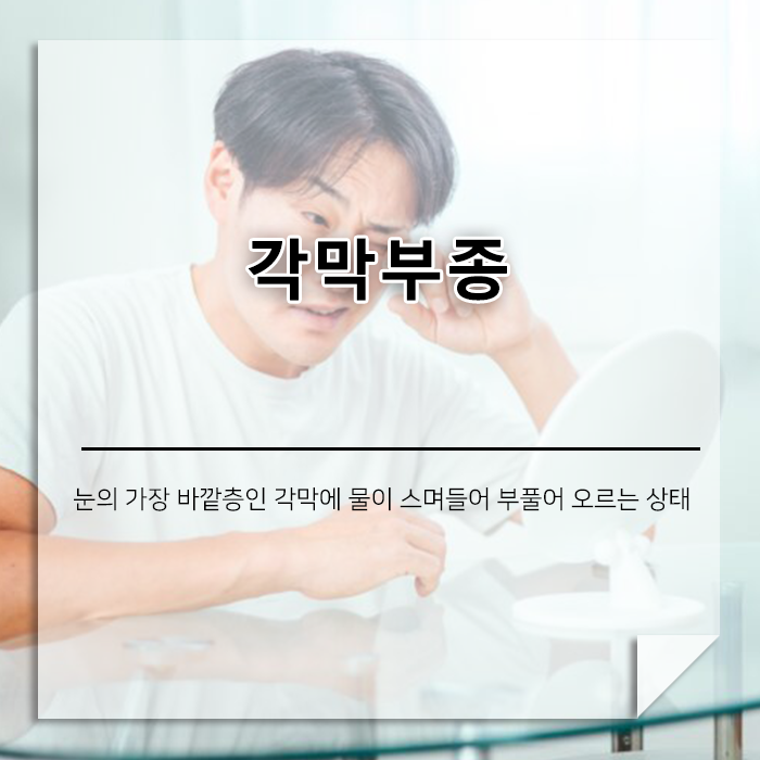 흐릿하게 보이는 세상, ‘각막 부종(Corneal Edema)’이란?