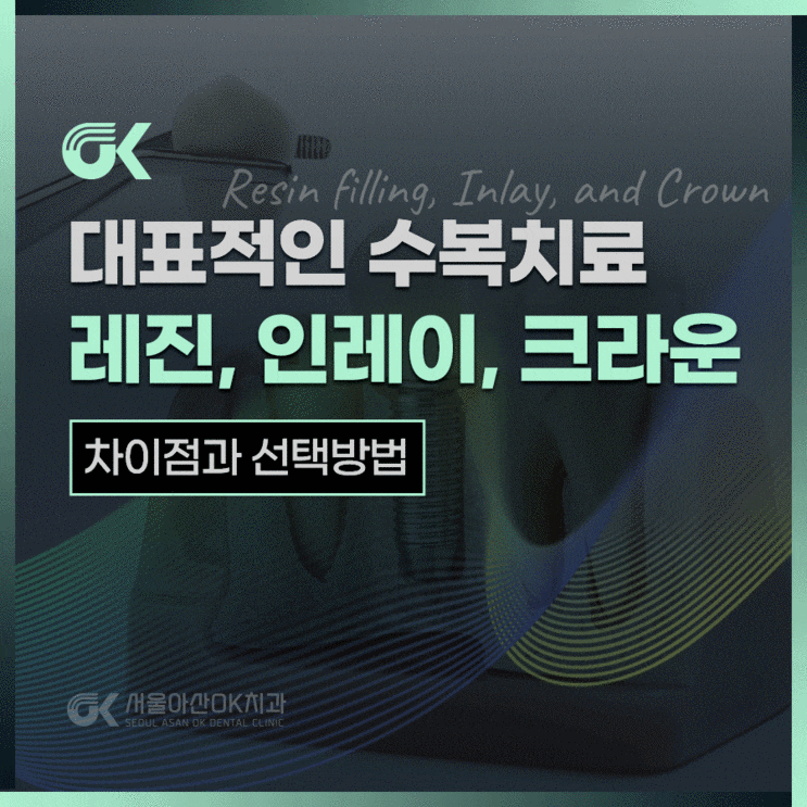  하남 레진, 인레이, 크라운 종류별 차이점