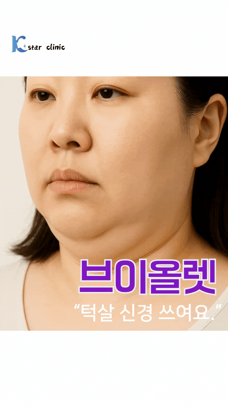  광주이중턱 생겼을 때 얼굴 비만 브이올렛 주사로 해결한다면