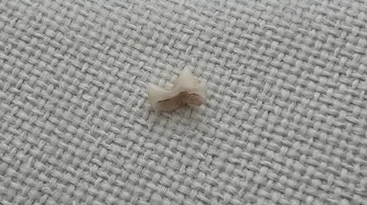  고양이 유치 관리 경험: 모카 성장기 치아 변화와 주의 사항