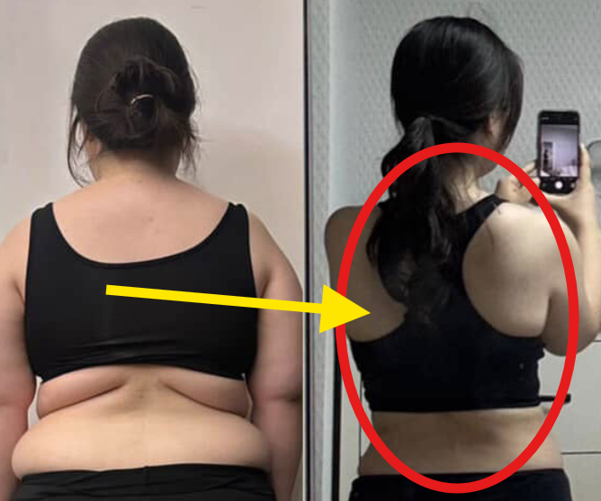  ️ “의사 한마디에 정신 번쩍!” 카페 음료 끊고 2년간 45kg 감량한 조유진의 진짜 다이어트 루틴
