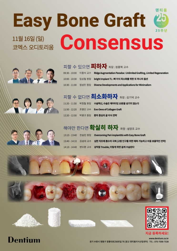  [탕정치과] Easy Bone Graft Consensus에 다녀왔습니다.
